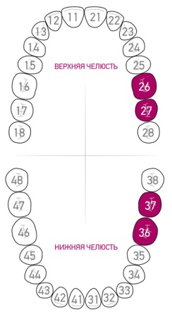 Кламп для коффердама Dentech (Япония) 204